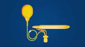 سعر دعامة الانتصاب Boston Scientific AMS 700 بوستون ساينتيفيك اي ام اس ٧٠٠