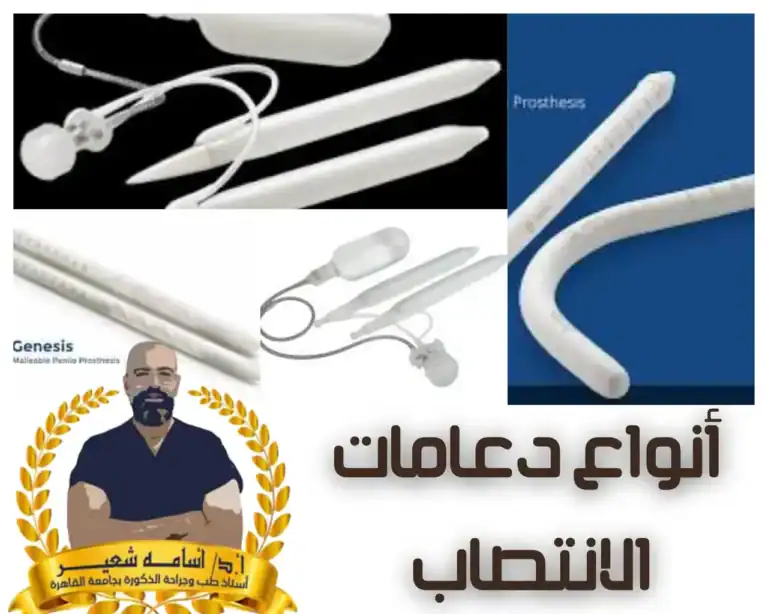 ‏ ‏أنواع ‏دعامة الانتصاب | ‏مقارنة دعامة العضو الذكرى الصلبة مع دعامة القضيب الهيدروليكية